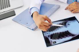 Aplazi Nedir?