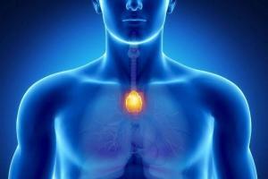 Aplazi Nedir?