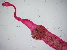 Echinococcus Granulosus Kistinin Hidatik Yapısı (Larva Dönemi)