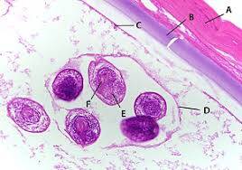 Echinococcus Granulosus Kistinin Hidatik Yapısı (Larva Dönemi)
