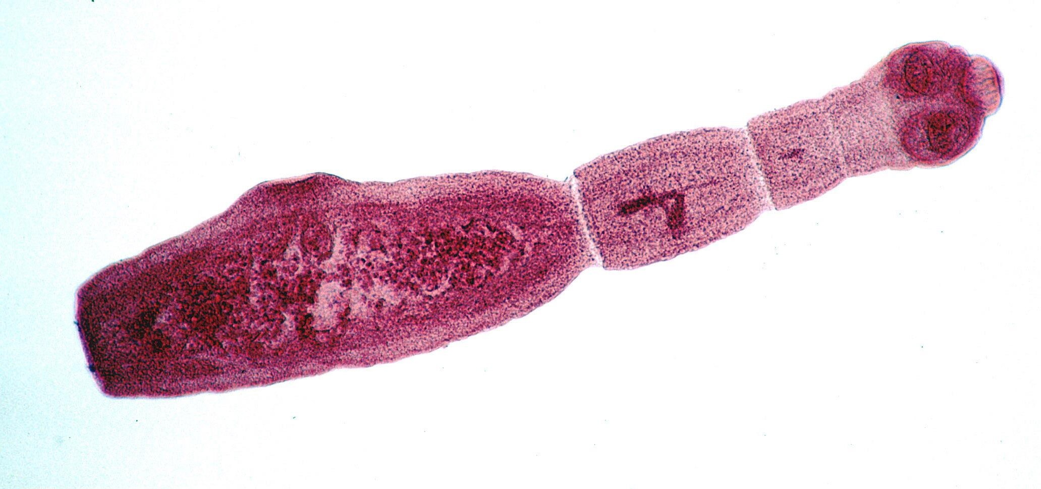 Echinococcus Granulosus Kistinin Hidatik Yapısı (Larva Dönemi)