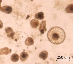 Echinococcus Granulosus (Hidatik Solucan) Nedir?
