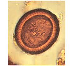 Echinococcus Granulosus (Hidatik Solucan) Nedir?