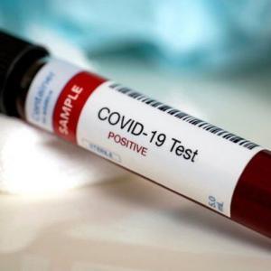 Farkında Olmadan COVID-19 Geçirmiş Olabileceğinizi Gösteren İşaretler