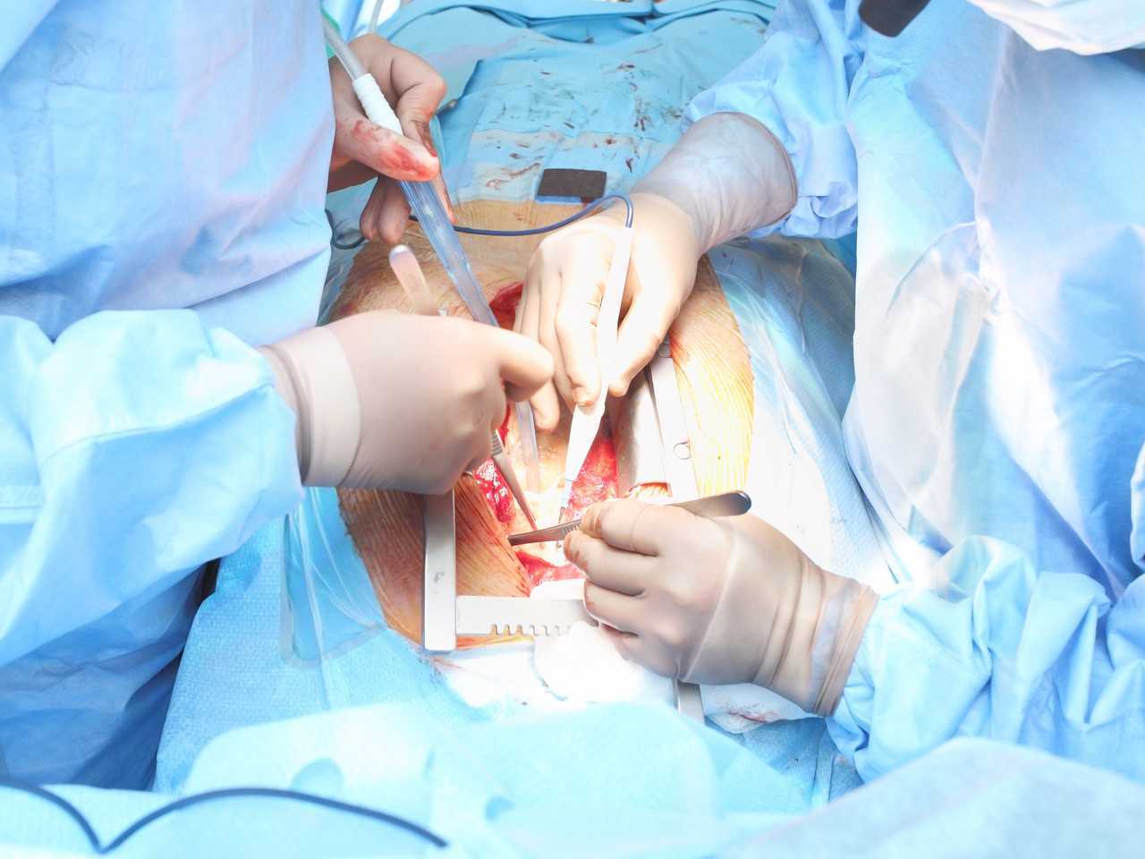 Büyük Arterlerin Transpozisyonunda (TGA) Cerrahi Yönetim ve Prosedürler