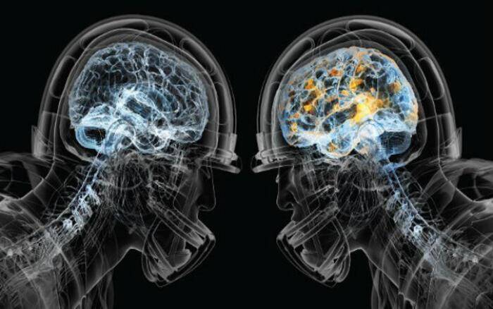 Travmatik Beyin Hasarı Sonrası İntihar Klinik Tanımlaması, Tanısı ve Epidemiyoloji