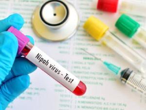 Nipah Virüsü: Bu Ölümcül Hastalığın Nedenleri, Belirtileri ve Tedavisi