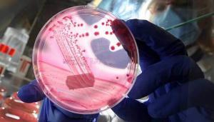 Antibiyotik Direnci Nedir? Türleri Ve Önleme Yolları