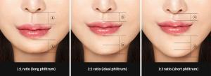 Filtrum (Philtrum) Nedir?